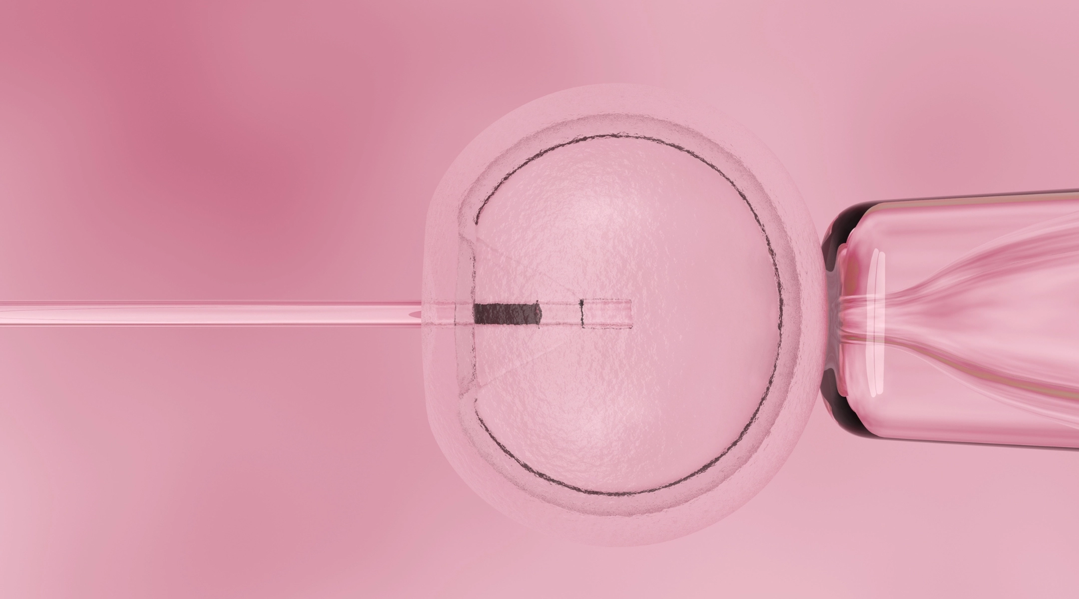 Un groupe juif de fertilité aide les clients de l'Alabama à subir une FIV ailleurs après la décision explosive de l'État sur la « personnalité fœtale »